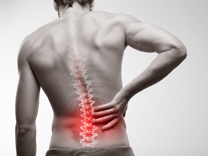 Lower Back Pain: Muscles & Ligaments