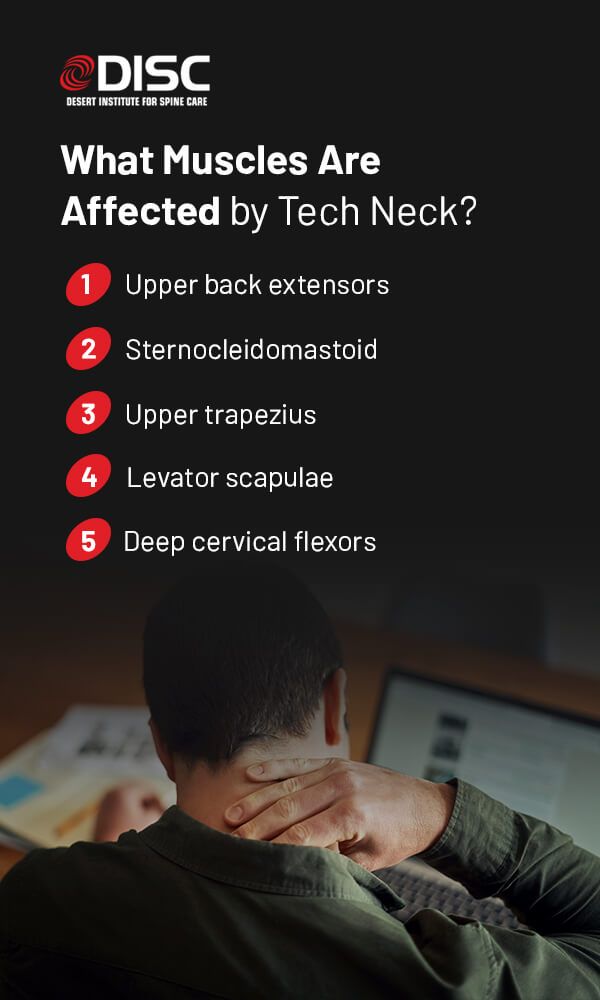 What could possibly be going on with your neck? Three main reasons for neck  tension - Sequence Wiz