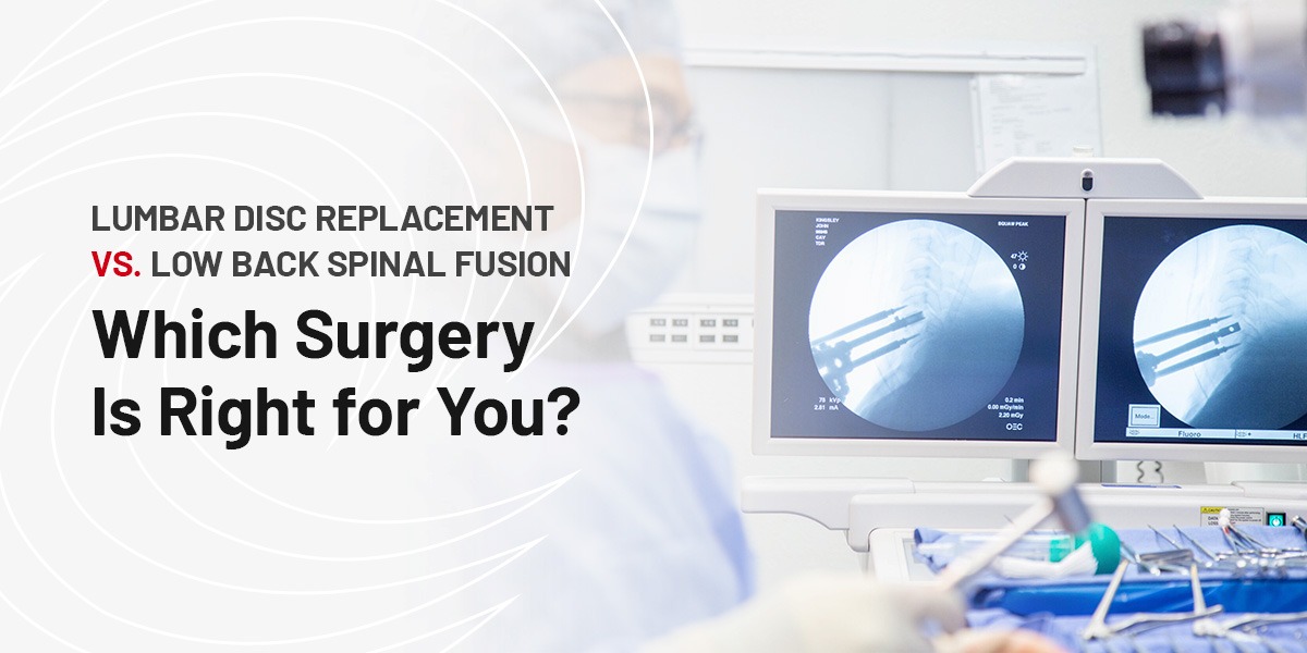 Lumbar Disc Replacement vs. Low Back Spinal Fusion: Which Surgery Is Right for You?