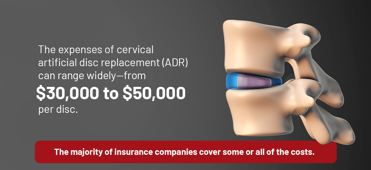 The expenses associated with this procedure can range widely—from $30,000 to $50,000 per disc. 